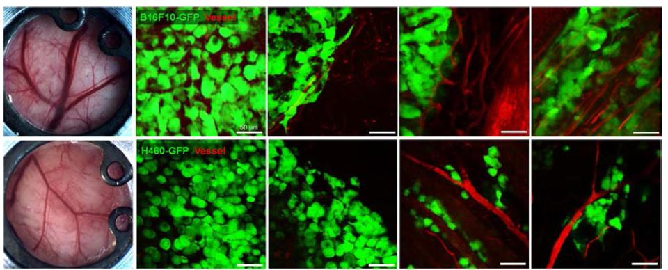 B16F10-GFP melanoma 및 H460-GFP NSCLC 종양세포의 부위별 morphology 및 혈관 주변부 정렬을 영상화한 결과.