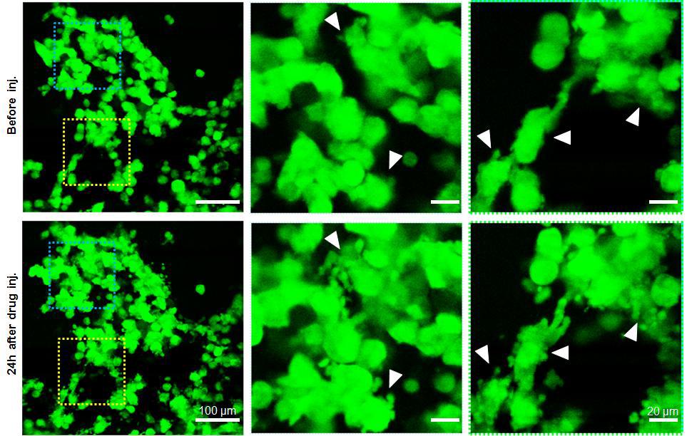 항암제 처리에 따른 암세포의 apoptosis 관찰 결과.