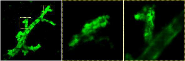 유방 영상 챔버를 통해 Actin-GFP 쥐의 유관 세포 및 구조를 영상화.