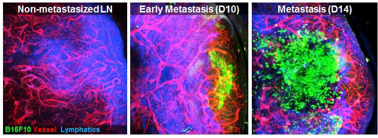 B16F10 melanoma 세포가 전이된 림프절의 영상화 결과