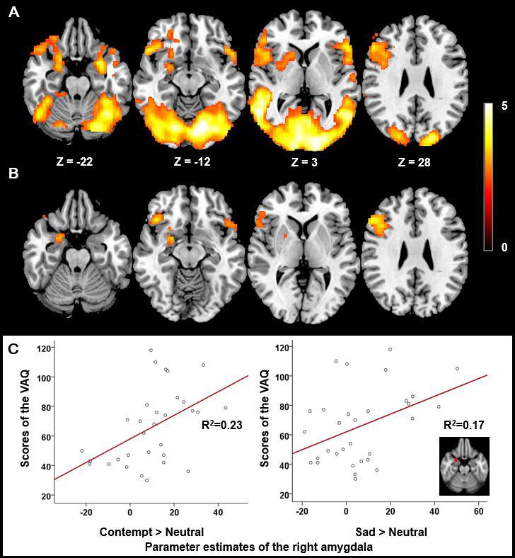(A) 내현적인 부정적 얼굴감정자극 처리에 있어서 활성화되는 뇌 영역. (B) 언어폭력의 정도와 활성도 사이에 양의 상관관계를 가지는 뇌영역. (C) 언어폭력과 경멸(좌), 슬픔(우) 얼굴에 따른 우측 편도체 활성도와의 관련성 회귀 그래프