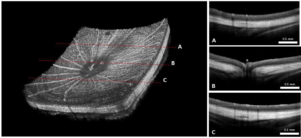 설치류 용 고속 다기능 망막 OCT 시스템으로 이미징한 렛트의 해부학적 미세구조 이미지