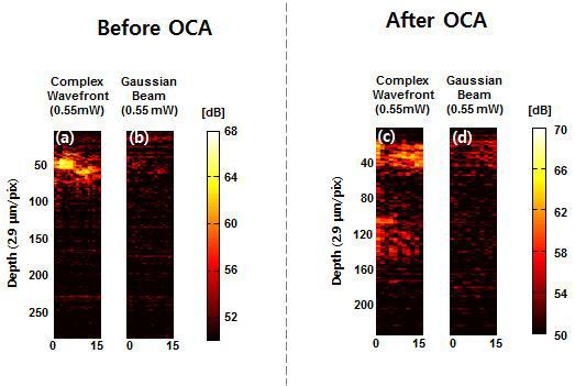 OCA 처리 전의 (a) 쥐 귀의 최적화 이미지, (b) 비최적화 이미지. OCA 처리 후의 (c) 쥐 귀의 최적화 이미지와 (e) 비최적화 이미지.