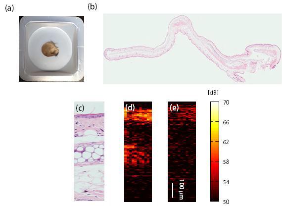 (a) 쥐의 귀 사진 (b) 쥐의 귀의 histology 이미지 (c) 확대된 부분 histology 이미지. OCA 처리 후의 (d) 쥐 귀의 최적화 이미지와 (e) 비 최적화 이미지.