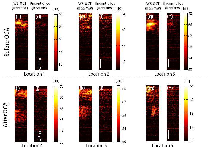 OCA를 투과 하기 전, 서로 다른 세 위치에서 최적화 이미지(c,e,g)와 각각에 대응하는 비최적화 이미지(d,f,h). OCA를 투과한 후, 근방의 다른 세 위치에서 최적화 이미지(i,k,m)와 각각에 대응하는 비최적화 이미지(j,l,n).