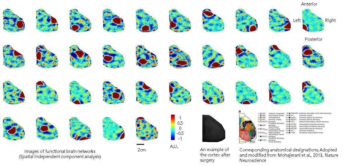 정상 마우스 대뇌피질의 기능적 네트워크 맵