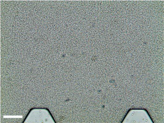 The initial distribution of bacteria in a saturated microfluidic chip. Scale bar: 100µm