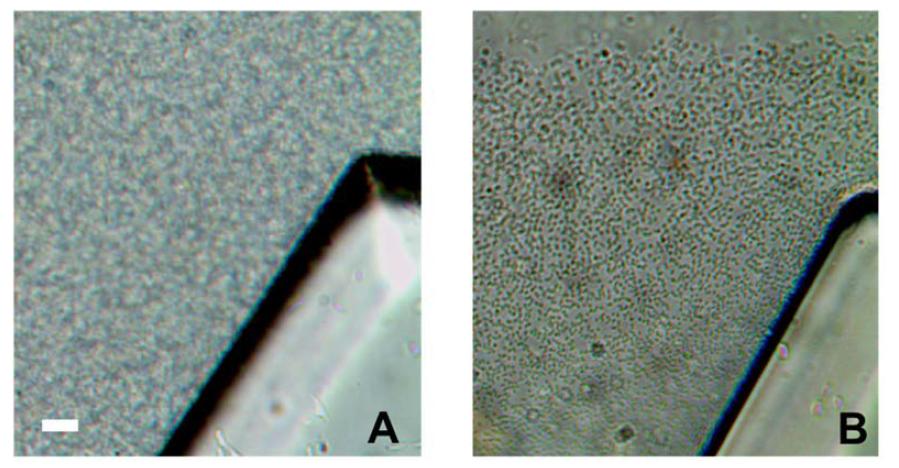 The initial distribution of bacteria (A), and residual(adhesive) cells after washing (B). Scale bar: 10µm