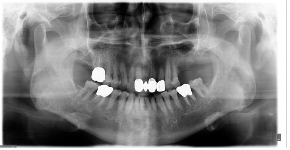 Panoramic radiograph on first visit