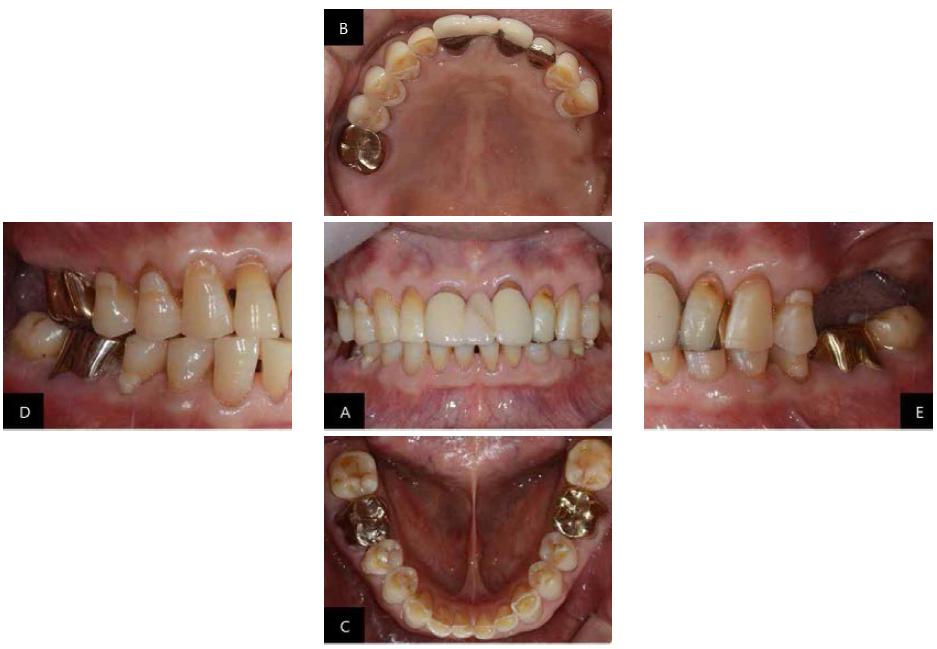 Postoperative intraoral view.