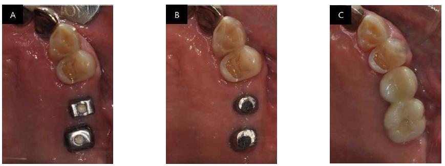 Clinical photographs of this case