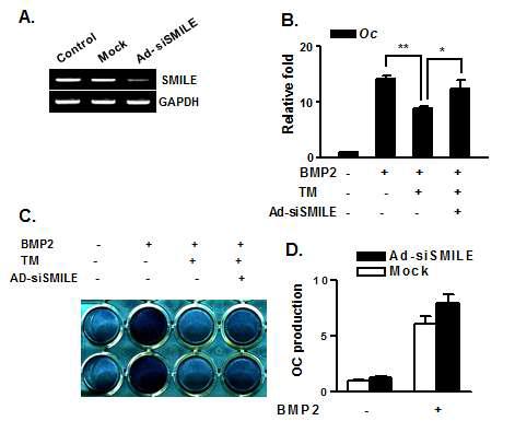 Inhibition of SMILE Recovers TM-induced Repression of Osteogenic Genes