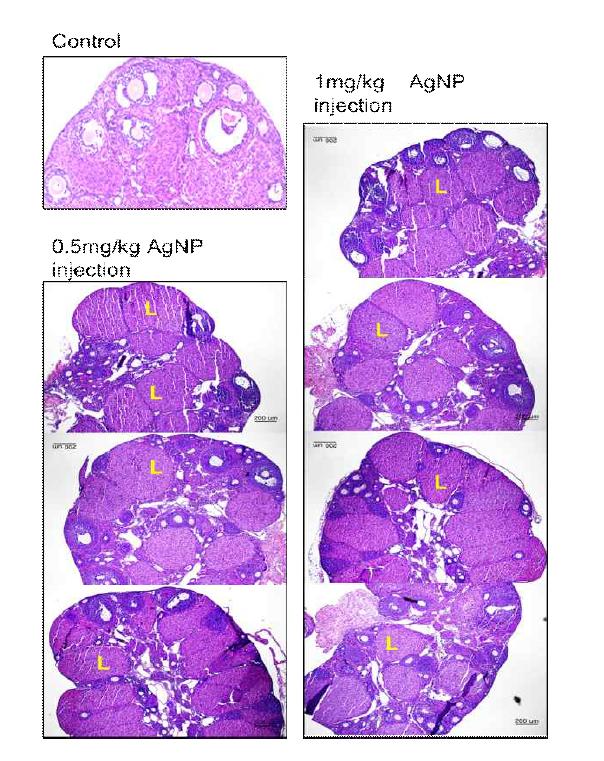 은 나노 입자가 처리 된 생쥐의 난소에서 관측 된 Leutral 세포(L)의 증가