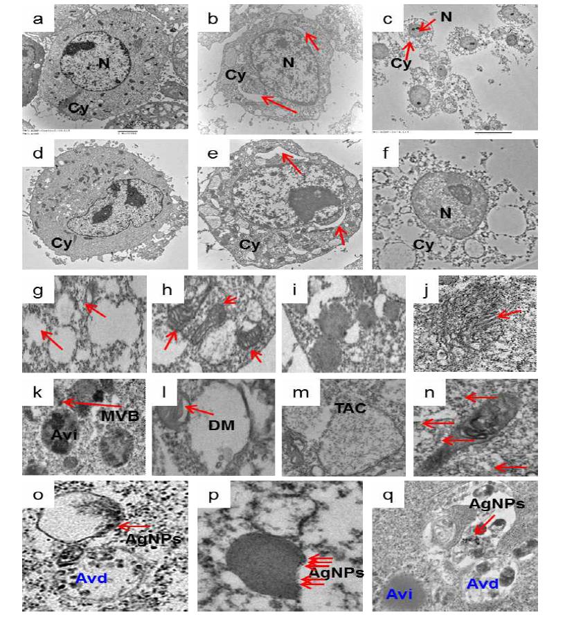 Cellular Uptake of AgNPs Induces Accumulation of Autophagosomes and Autolysosomes