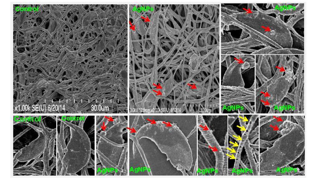 Localization of AgNPs in Sperm Cells by SEM