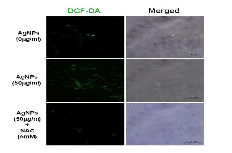 NAC Treatment Decreases AgNPs-mediated Oxidative Stress in Sperm Cells