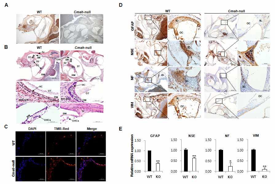 Age-related Inner Ear Abnormality and Neuron Cell Loss inCMAH-null Mice