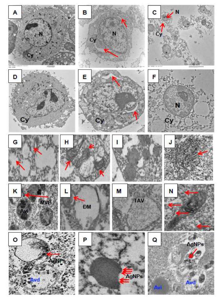 Cellular Uptake of AgNPs Induces Accumulation ofAutophagosomes and utolysosomes