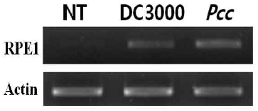 RPE1 유전자의 발현분석