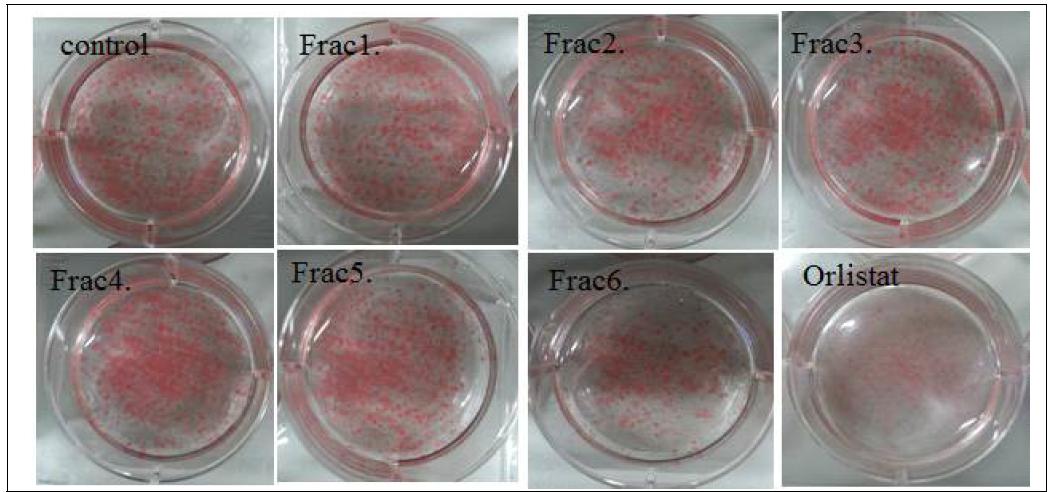 오픈컬럼 fractions 의 oil red O staining 결과