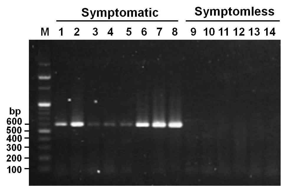 YNMoV에 대한 PCR 진단 산물의 전기영동 결과.