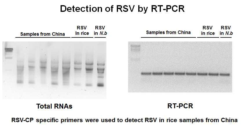 RT-PCR를 이용하여 중국 시료로부터 RSV검정