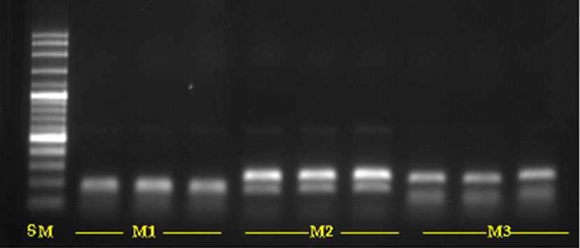 LS1-LS9의 Multiplex PCR 전기영동 사진