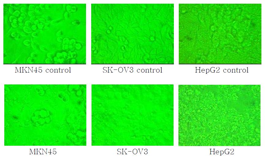 An inverted photomicrograph of MKN45, SK-OV3, and HepG2. Ethyl acetate fraction treated 0.2㎍/㎕, 48hr.