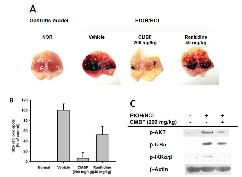 Mice given CMBF (200 mg/kg) or ranitidine (40 mg/kg)orally for 2 days were orally treated with EtOH/HCl.