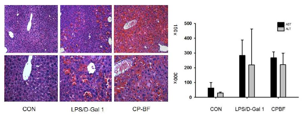 In vivo anti-inflammatory effect of AG on LPS-induced hepatitis animal models. Mice were administered CPBF orally for 6 days and treated intraperitoneally with LPS or LPS/D-galactosamine to induce hepatitis.