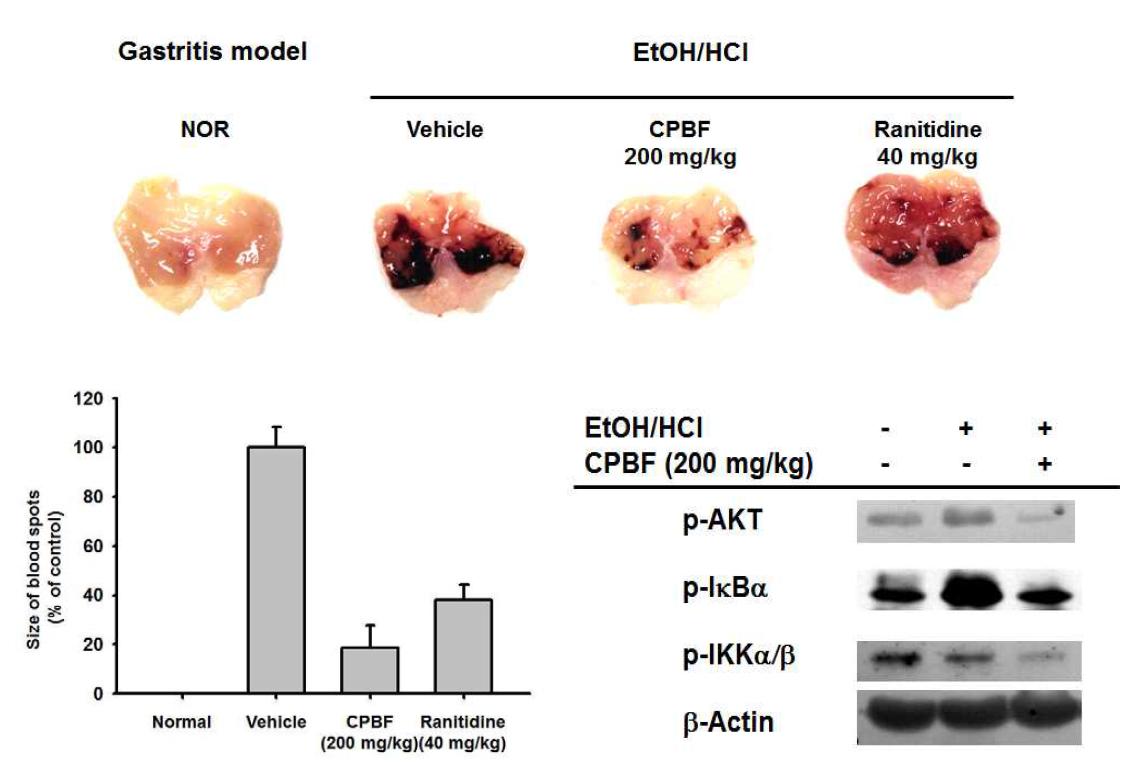 Mice given CPBF (200 mg/kg) or ranitidine (40 mg/kg) orally for 2 days were orally treated with EtOH/HCl.