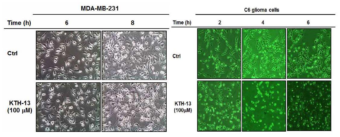 MDA-MB-231 cell과 C6 glioma cell에서 KTH-13의 처리시간에 따른 세포 모양 변화