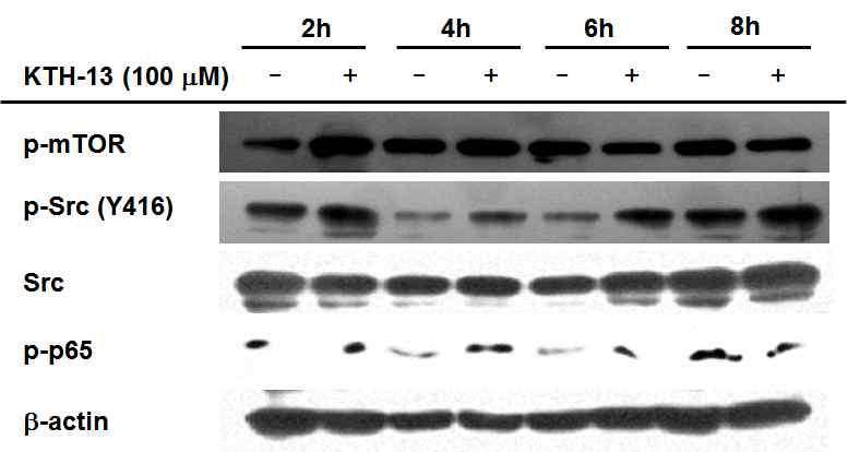 KTH-13의 항암 관련 기전 억제 효능 평가