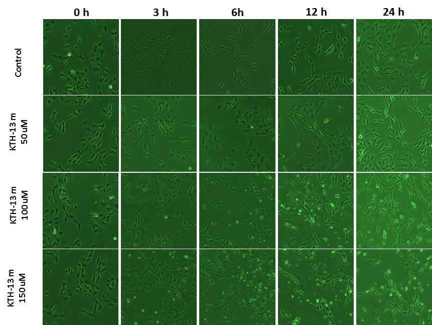 KTH-13-mono의 농도별 시간별 암세포 모양변화 양상