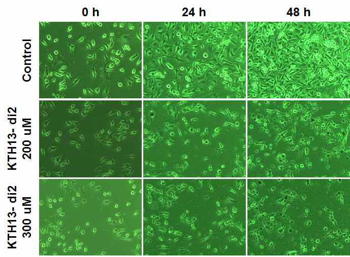 KTH-13 diastereomer2에 의한 암세포의 형태변화 측정