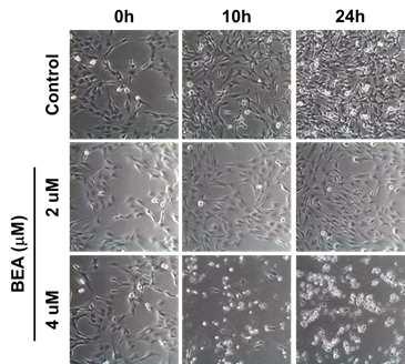 Beauvericin에 의한 C6 cell의 형태 변화