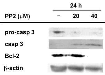 PP2에 의한 세포자살 관련 단백질의 양 변화
