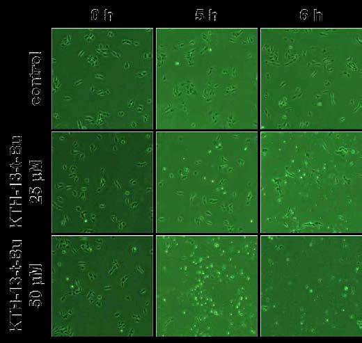 KTH-13-t-Bu의 세포형태 변화 유발