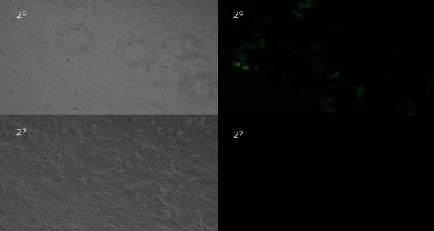 KSHV stock과 PBS 혼합물을 iSLK-cell에 감염시켰을 때 관찰되는 GFP 발현