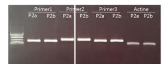 Primer에 따른 심비디움 STPS 유전자 Reverse Transcription PCR