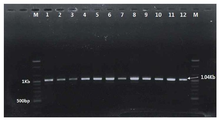 밀양지역 딸기 시설재배지 뿌리혹선충의 28S PCR 결과