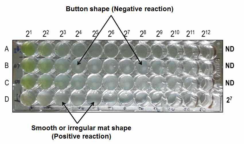 Microplate agglutination test for Salmonella Gallinarum antibody