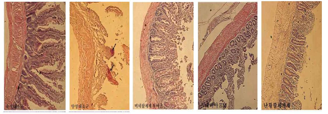 소장의 조직학적 병변