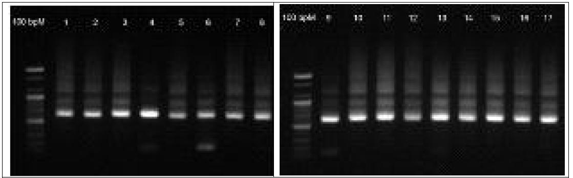 V3 genomic region에 대한 개체별 전기영동 형태