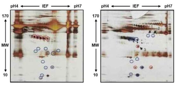 알부민 제거 전(좌), 후(우)의 2-DE gel.