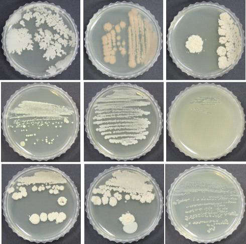 분리된 9가지 미생물상.