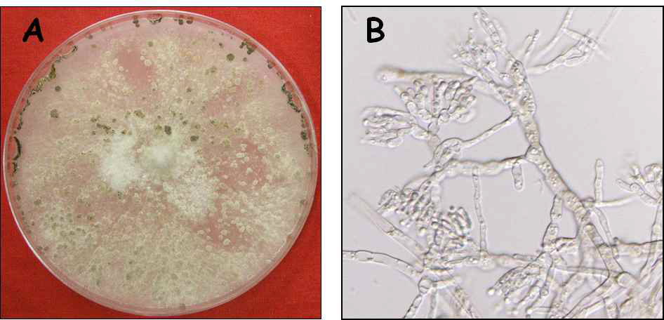 참다래 균핵병균(Sclerotinia sclerotiorum)의 균총과 균핵(A) 및 spermatia(B)