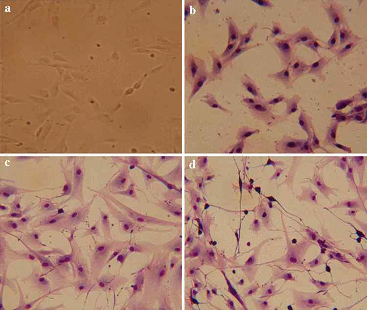 Morphological appearance of neural differentiated canine amniotic fluid mesenchymal stem cells