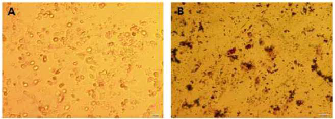 Differentiation potential of canine mesenchymal stem cells derived from bone marrow into adipocyte. (A) adipocyte differentiated MSC, (B)oil red O staining