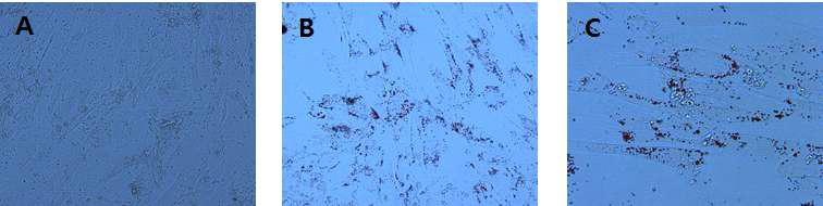 Adipocyte fifferentiation of canine blood MSC. (A) MSC convert to adipocyte, (B)oil red O staining(x20), (C)oil red O staining(x40)